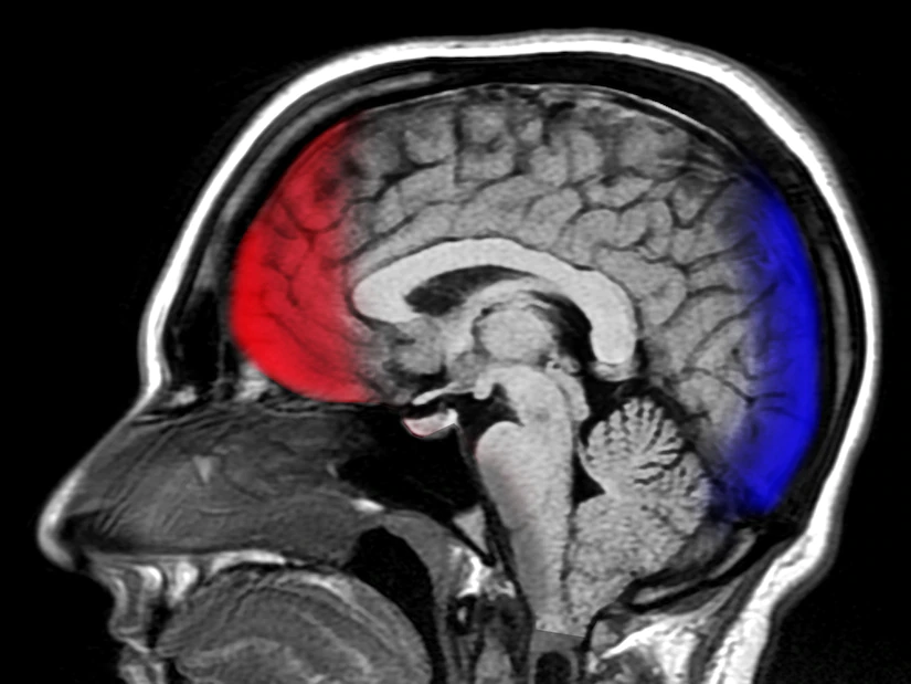 Medico Legal Expertise for Traumatic Brain Injury